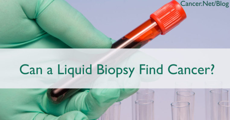 Liquid Biopsy – promising advances in early cancer detection